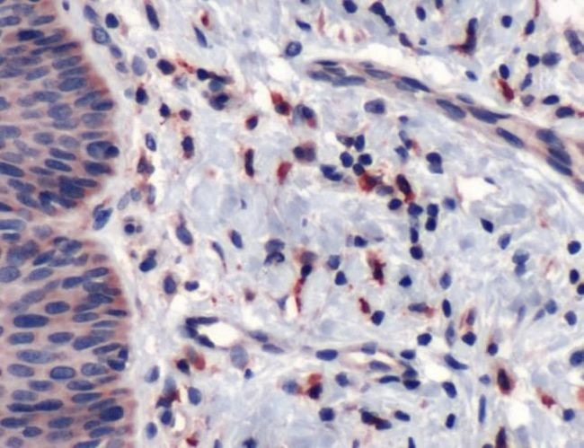 CD163 Antibody in Immunohistochemistry (IHC)