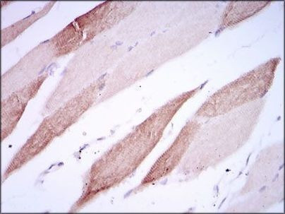 CD166 Antibody in Immunohistochemistry (Paraffin) (IHC (P))