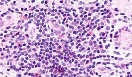 CXCR2 Antibody in Immunohistochemistry (Paraffin) (IHC (P))