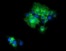 CD19 Antibody in Immunocytochemistry (ICC/IF)