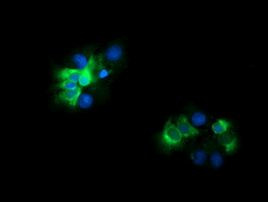 CD19 Antibody in Immunocytochemistry (ICC/IF)