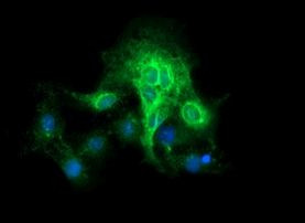 CD19 Antibody in Immunocytochemistry (ICC/IF)