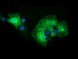 CD19 Antibody in Immunocytochemistry (ICC/IF)