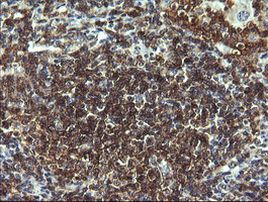 CD19 Antibody in Immunohistochemistry (Paraffin) (IHC (P))