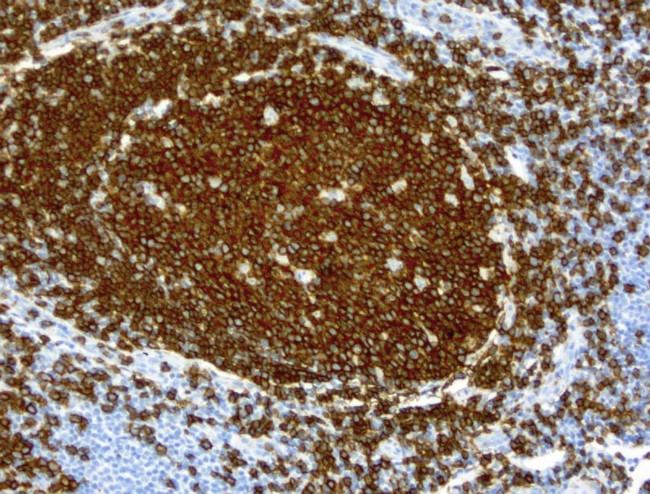 CD19 Antibody in Immunohistochemistry (Paraffin) (IHC (P))