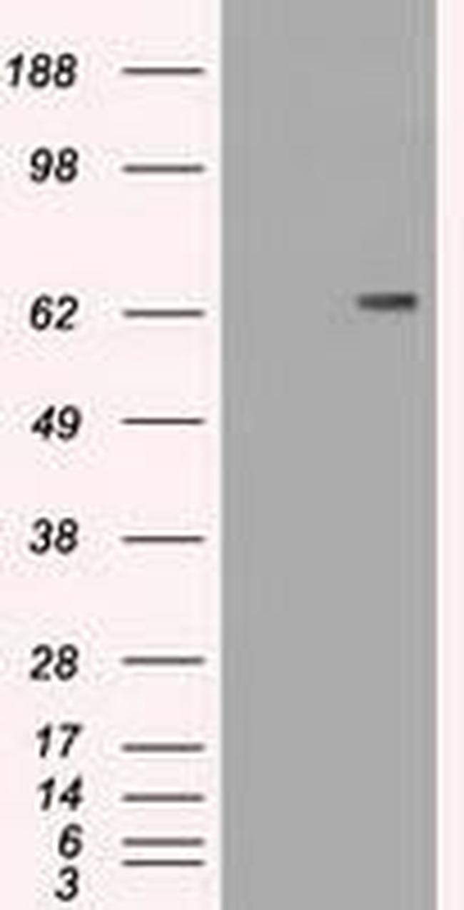 CD19 Antibody in Western Blot (WB)