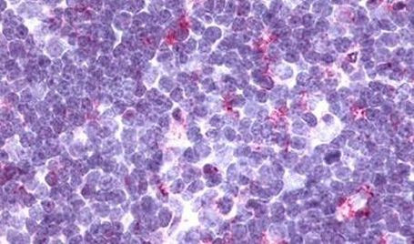 CCR9 Antibody in Immunohistochemistry (Paraffin) (IHC (P))