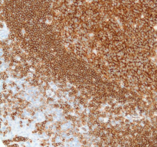 CD19 Antibody in Immunohistochemistry (Paraffin) (IHC (P))