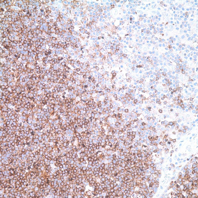 CD1a Antibody in Immunohistochemistry (IHC)
