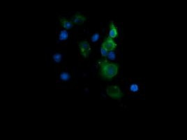 CD1C Antibody in Immunocytochemistry (ICC/IF)