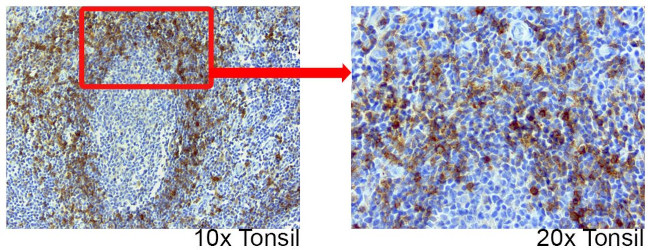 CD1C Antibody in Immunohistochemistry (Paraffin) (IHC (P))