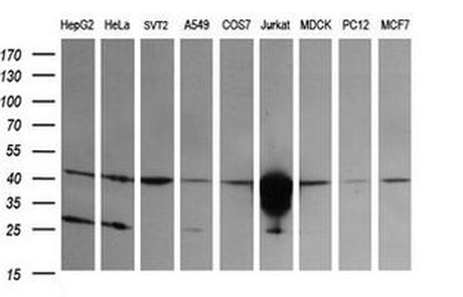 CD1C Antibody in Western Blot (WB)