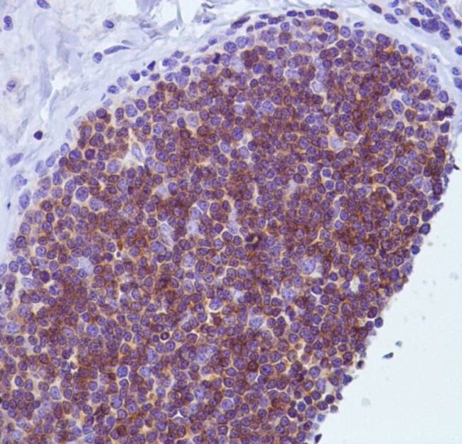 CD1a Antibody in Immunohistochemistry (IHC)
