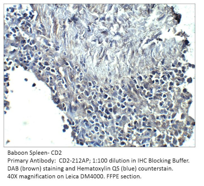 CD2 Antibody in Immunohistochemistry (IHC)