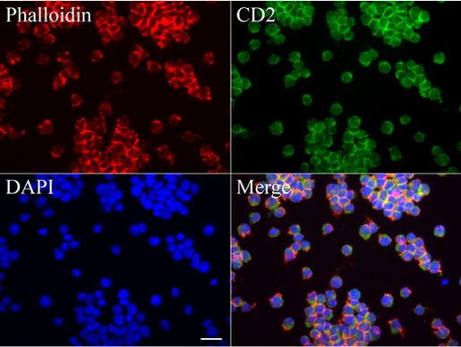 CD2 Antibody in Immunocytochemistry (ICC/IF)
