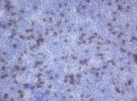CD2 Antibody in Immunohistochemistry (Paraffin) (IHC (P))