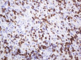 CD2 Antibody in Immunohistochemistry (Paraffin) (IHC (P))