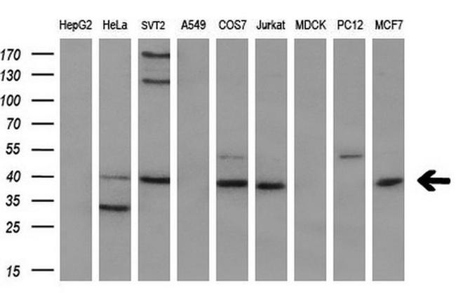 CD2 Antibody in Western Blot (WB)