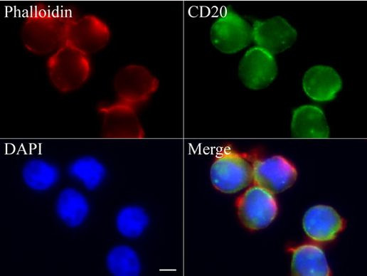 CD20 (MS4A1) Antibody in Immunocytochemistry (ICC/IF)