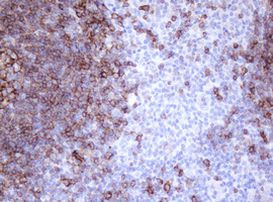 CD20 (MS4A1) Antibody in Immunohistochemistry (Paraffin) (IHC (P))