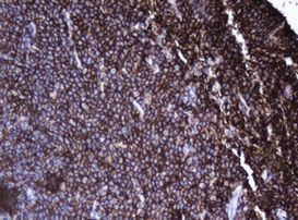 CD20 (MS4A1) Antibody in Immunohistochemistry (Paraffin) (IHC (P))