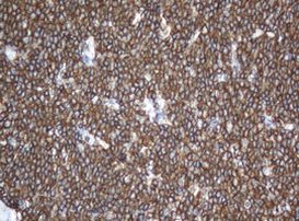 CD20 (MS4A1) Antibody in Immunohistochemistry (Paraffin) (IHC (P))