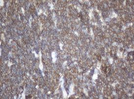 CD20 (MS4A1) Antibody in Immunohistochemistry (Paraffin) (IHC (P))