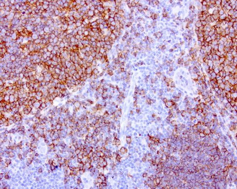 CD20 (MS4A1) Antibody in Immunohistochemistry (Paraffin) (IHC (P))