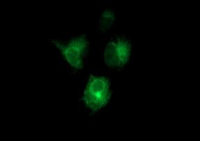 CD22 Antibody in Immunocytochemistry (ICC/IF)