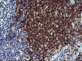 CD22 Antibody in Immunohistochemistry (Paraffin) (IHC (P))