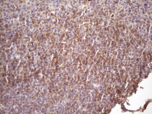 CD22 Antibody in Immunohistochemistry (Paraffin) (IHC (P))
