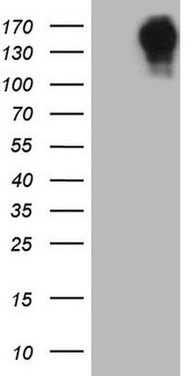 CD22 Antibody in Western Blot (WB)