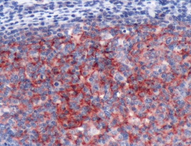 CD23 Antibody in Immunohistochemistry (IHC)