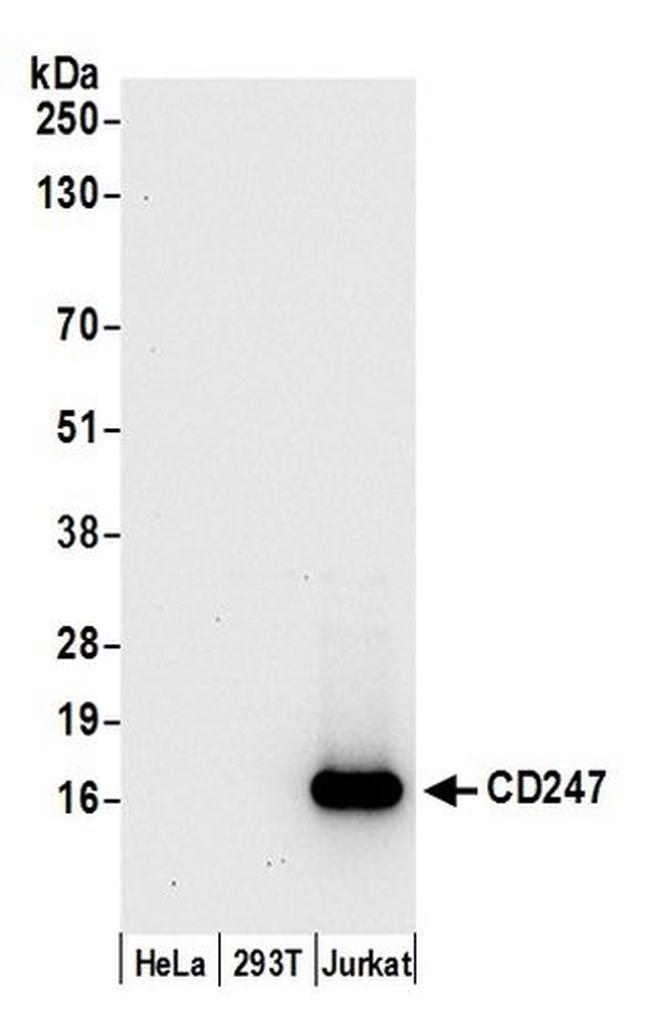 CD247/CD3Z Antibody in Western Blot (WB)