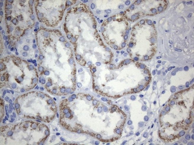 CD248 Antibody in Immunohistochemistry (Paraffin) (IHC (P))
