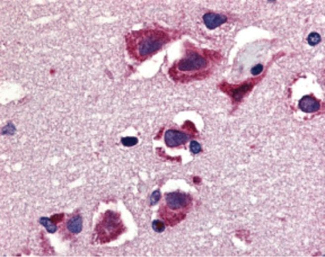 TRAIL (CD253) Antibody in Immunohistochemistry (IHC)