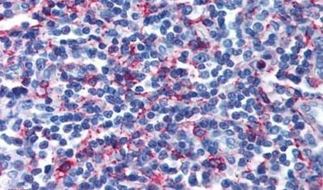 CRTH2 Antibody in Immunohistochemistry (Paraffin) (IHC (P))