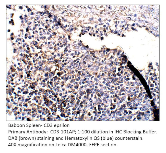 CD3 epsilon Antibody in Immunohistochemistry (IHC)