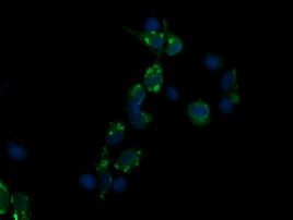 CD3 Antibody in Immunocytochemistry (ICC/IF)