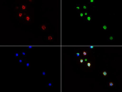 CD3 Antibody in Immunocytochemistry (ICC/IF)