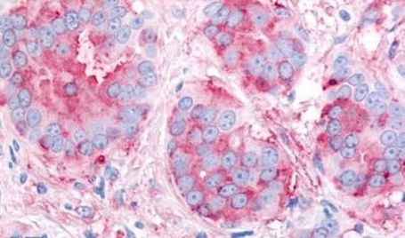 VEGF Receptor 2 Antibody in Immunohistochemistry (Paraffin) (IHC (P))