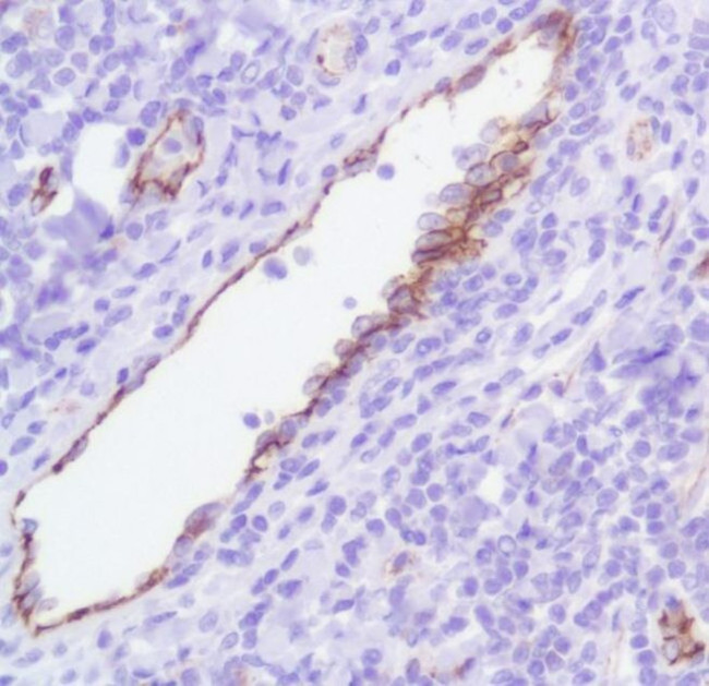 CD31 Antibody in Immunohistochemistry (Paraffin) (IHC (P))