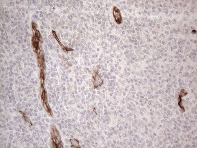CD34 Antibody in Immunohistochemistry (Paraffin) (IHC (P))