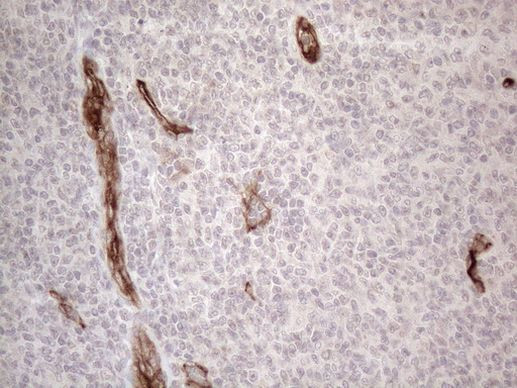 CD34 Antibody in Immunohistochemistry (Paraffin) (IHC (P))