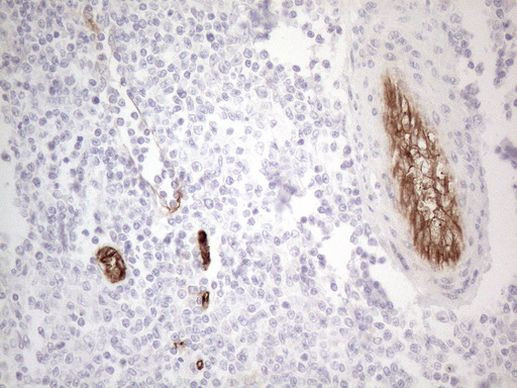 CD34 Antibody in Immunohistochemistry (Paraffin) (IHC (P))