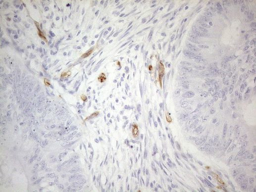 CD34 Antibody in Immunohistochemistry (Paraffin) (IHC (P))