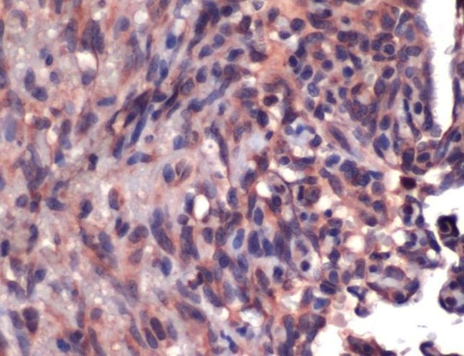 CD34 Antibody in Immunohistochemistry (IHC)