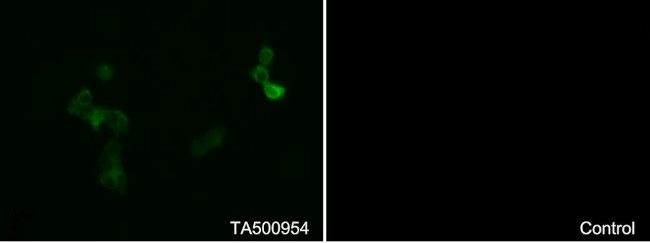 CD36 Antibody in Immunocytochemistry (ICC/IF)