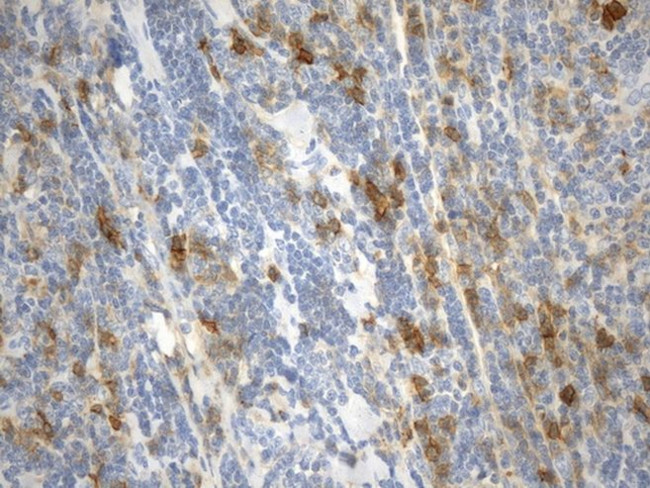 CD38 Antibody in Immunohistochemistry (Paraffin) (IHC (P))