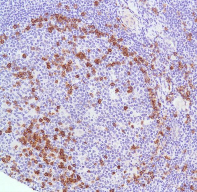 CD38 Antibody in Immunohistochemistry (IHC)